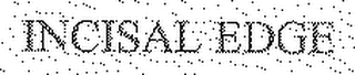 INCISAL EDGE